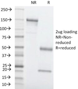 CEACAM5/CD66e Antibody (C66/1260), Novus Biologicals 0.2mg; Unlabeled:Antibodies,